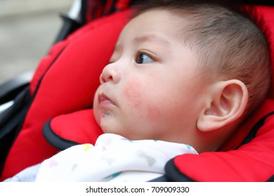 Cute Baby Boy Playful Bubbles Saliva Drool On Child Mouth With Allergic Rash On Kid Chubby Cheeks