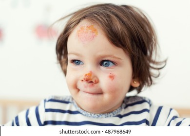 Cute Baby Girl With Bruises On Her Face 