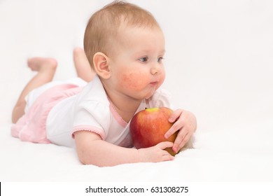 A Cute Baby Girl With A Dermatitis On Her Cheeks Is Eating A Red Apple On An Isolated White Background. Food Allergy