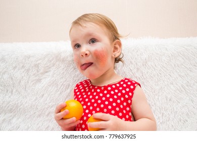 Cute Little Girl Child Eczema Allergy Stock Photo 779637925 | Shutterstock