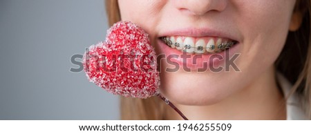 Cute woman with braces on her teeth holds a candy in the form of a heart on white background. Copy space