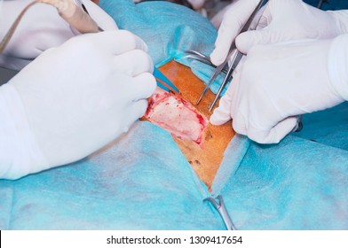 Cutting Of The Skin Of The Surgical Site (the Concept Of Surgery)