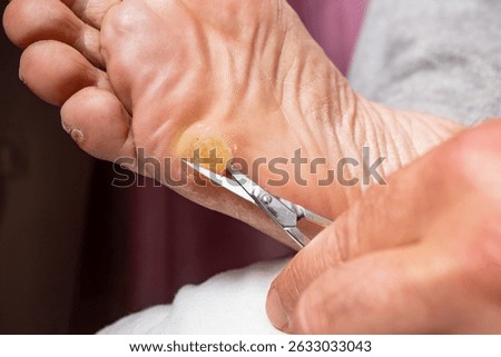 Cutting a sole callus with a silver scissors, soft focus close up