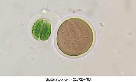 A Cyanobacteria Called Chroococcus  Sp. 400x Microscope Magnification + 10x Camera Zoom