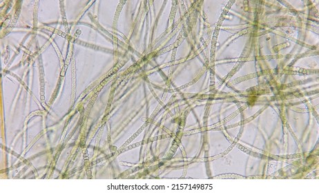 Cyanobacteria Called Nostoc Sp. Collected From Wetland. 400x Microscope Magnification + 2x Camera Zoom