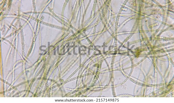 Cyanobacteria called\
Nostoc sp. collected from wetland. 400x microscope magnification +\
2x camera zoom
