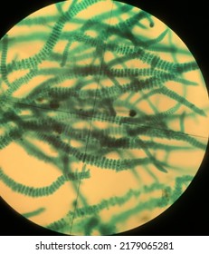Cyanobacteria, Viewed Under A Microscope.