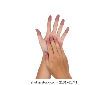 Cyanotic Hands Or Peripheral Cyanosis Or Blue Hands At Southeast Asian, Chinese Young Man