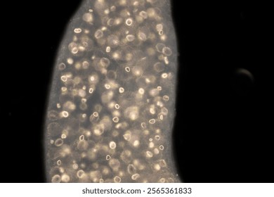 Cyctacanth stage (Acanthocephala) fish cestode larva (Trianchoratus sp.) in Channa striata under the microscope in Lab.