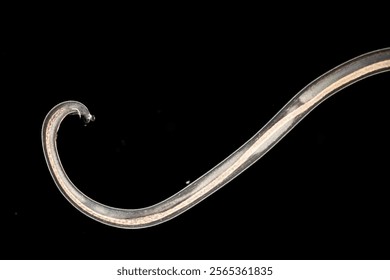 Cyctacanth stage (Acanthocephala) fish cestode larva (Trianchoratus sp.) in Channa striata under the microscope in Lab.