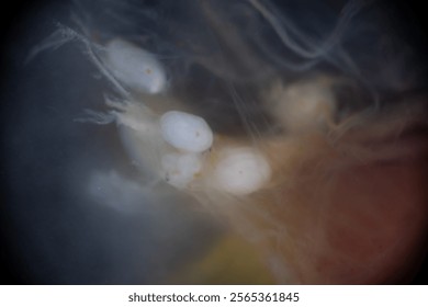 Cyctacanth stage (Acanthocephala) fish cestode larva (Trianchoratus sp.) in Channa striata under the microscope in Lab.
