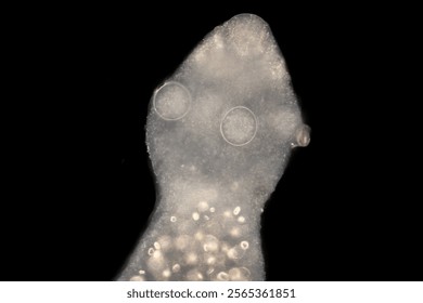 Cyctacanth stage (Acanthocephala) fish cestode larva (Trianchoratus sp.) in Channa striata under the microscope in Lab.