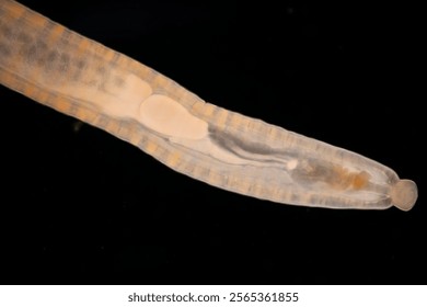 Cyctacanth stage (Acanthocephala) fish cestode larva (Trianchoratus sp.) in Channa striata under the microscope in Lab.