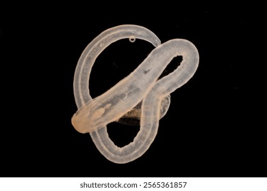 Cyctacanth stage (Acanthocephala) fish cestode larva (Trianchoratus sp.) in Channa striata under the microscope in Lab.
