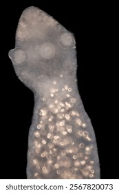 Cyctacanth stage (Acanthocephala) fish cestode larva (Trianchoratus sp.) in Channa striata under the microscope in Lab.