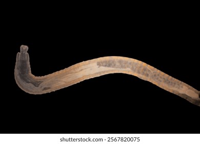 Cyctacanth stage (Acanthocephala) fish cestode larva (Trianchoratus sp.) in Channa striata under the microscope in Lab.