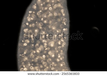 Cyctacanth stage (Acanthocephala) fish cestode larva (Trianchoratus sp.) in Channa striata under the microscope in Lab.