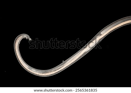 Cyctacanth stage (Acanthocephala) fish cestode larva (Trianchoratus sp.) in Channa striata under the microscope in Lab.