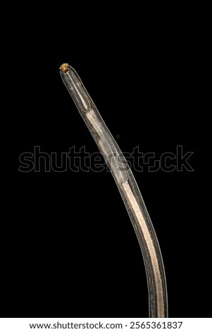 Cyctacanth stage (Acanthocephala) fish cestode larva (Trianchoratus sp.) in Channa striata under the microscope in Lab.