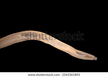 Cyctacanth stage (Acanthocephala) fish cestode larva (Trianchoratus sp.) in Channa striata under the microscope in Lab.