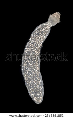 Cyctacanth stage (Acanthocephala) fish cestode larva (Trianchoratus sp.) in Channa striata under the microscope in Lab.
