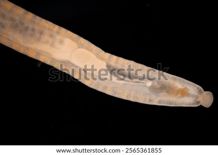 Cyctacanth stage (Acanthocephala) fish cestode larva (Trianchoratus sp.) in Channa striata under the microscope in Lab.