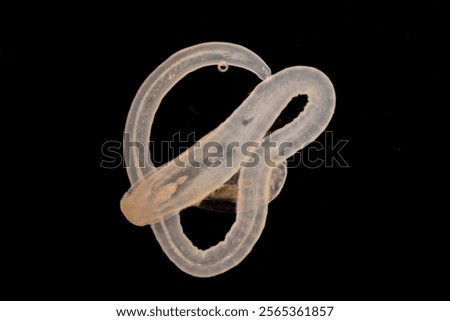 Cyctacanth stage (Acanthocephala) fish cestode larva (Trianchoratus sp.) in Channa striata under the microscope in Lab.