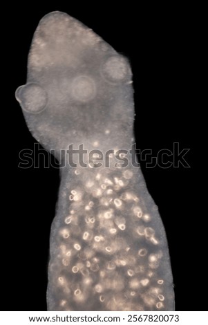 Cyctacanth stage (Acanthocephala) fish cestode larva (Trianchoratus sp.) in Channa striata under the microscope in Lab.
