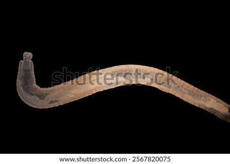 Cyctacanth stage (Acanthocephala) fish cestode larva (Trianchoratus sp.) in Channa striata under the microscope in Lab.