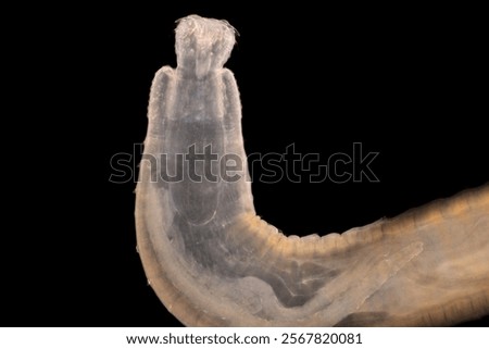 Cyctacanth stage (Acanthocephala) fish cestode larva (Trianchoratus sp.) in Channa striata under the microscope in Lab.