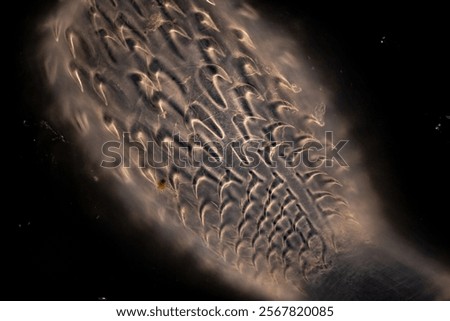 Cyctacanth stage (Acanthocephala) fish cestode larva (Trianchoratus sp.) in Channa striata under the microscope in Lab.