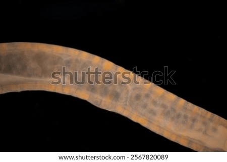 Cyctacanth stage (Acanthocephala) fish cestode larva (Trianchoratus sp.) in Channa striata under the microscope in Lab.