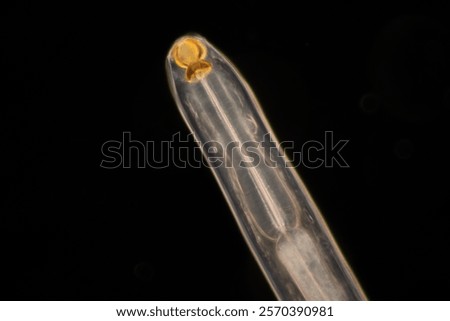Cyctacanth stage (Acanthocephala) fish cestode larva (Trianchoratus sp.) in Channa striata under the microscope in Lab.