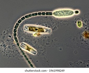 Cylindrospermum, A Filamentous Blue Green Alga (cyanobacteria), Cells Adhere To Each Other, Thick Walled Terminal Cell  (heterocysts) Has A Special Function. Light Microscope Image Of Living Cells.