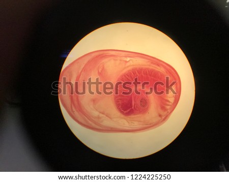 Cysticercus cellulosae in light microscope