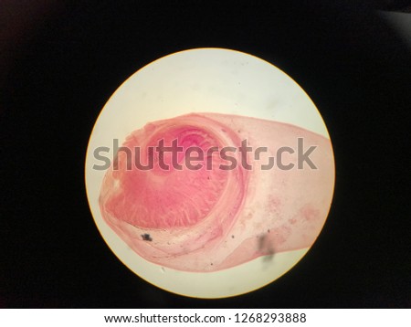 Cysticercus cellulosae in light microscope