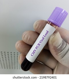 Cytomegalovirus (CMV) PCR Viral Load For DNA Detection And Quantification.