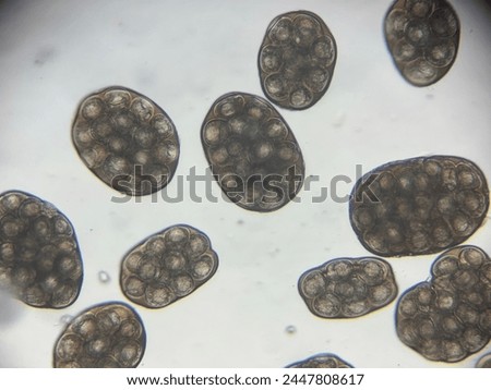D. Caninum egg packets. As seen under microscope