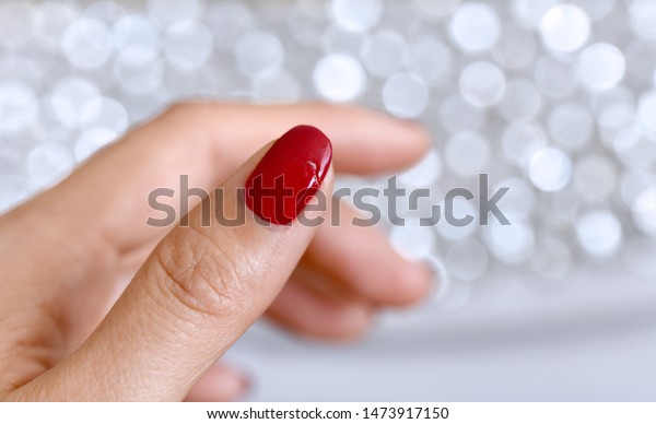 赤いマニキュアでメスの親指の爪を損傷 甲状腺疾患 甲状腺機能低下症 貧血など 多くの健康上の問題が原因で生じる脆弱な爪 の写真素材 今すぐ編集