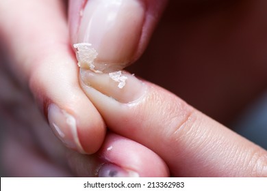 Damaged Nails