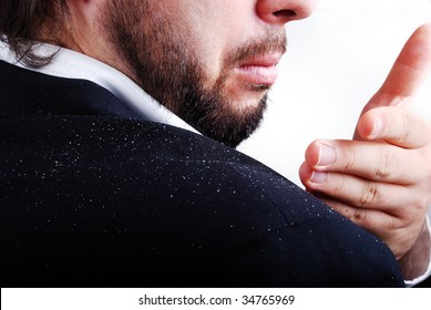 Dandruff Issue On Man's Sholder