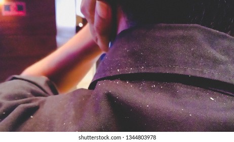 
Dandruff On A Man's Shoulder