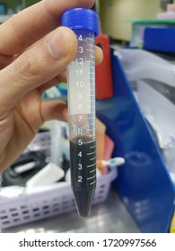 Dark Brown Urine - Hemoglobinuria In Immune-mediated Hemolytic Anemia Dog