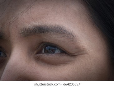 Dark circles around eye. - Shutterstock ID 664235557