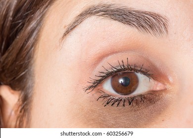 Dark Circles Under Eye Of Lady