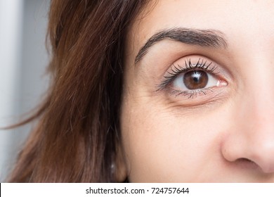 Dark Circles Under Eye Of Young Beautiful Woman