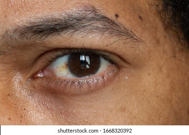 Sclera Images, Stock Photos & Vectors | Shutterstock