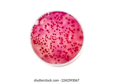 Dark red and pink colonies of mixed bacteria growing on red agar plate  - Shutterstock ID 2242393067