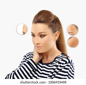 Dark spots, freckles,hyperpigmentation(melasma or chloasma)