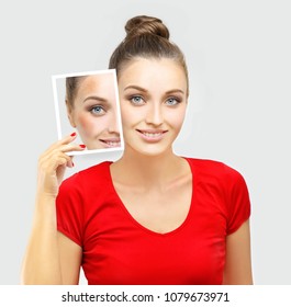 Dark spots, freckles,hyperpigmentation(melasma or chloasma)